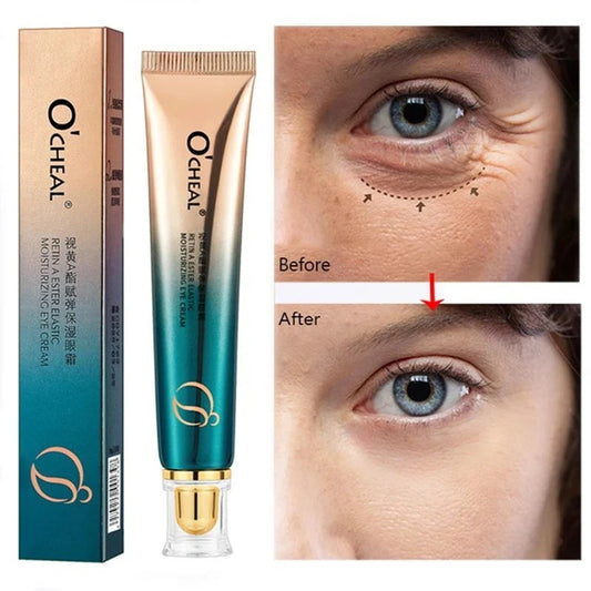 Anti-Wrinkles Eye Cream Retinol Remove Dark Circles Lifting Repair Cream