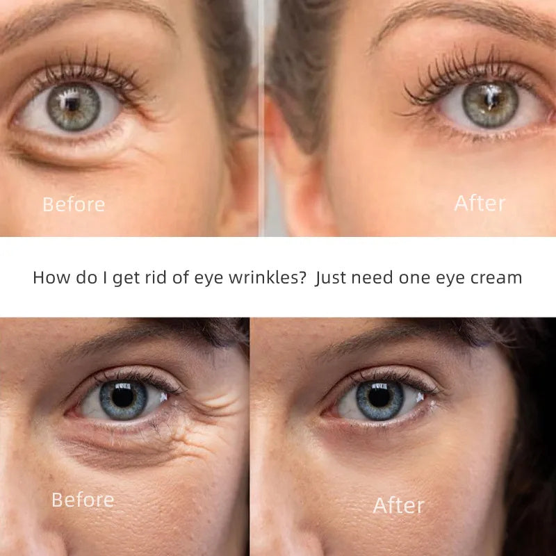 Anti-Wrinkles Eye Cream Retinol Remove Dark Circles Lifting Repair Cream