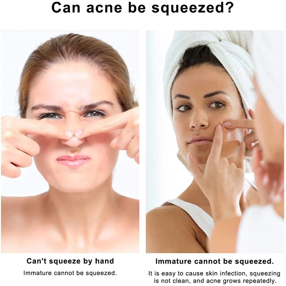 Blackhead Pimples 4pcs Stainless Steel Tools Set How To Pop Pimples Professional Kit