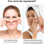 Blackhead Pimples 4pcs Stainless Steel Tools Set How To Pop Pimples Professional Kit