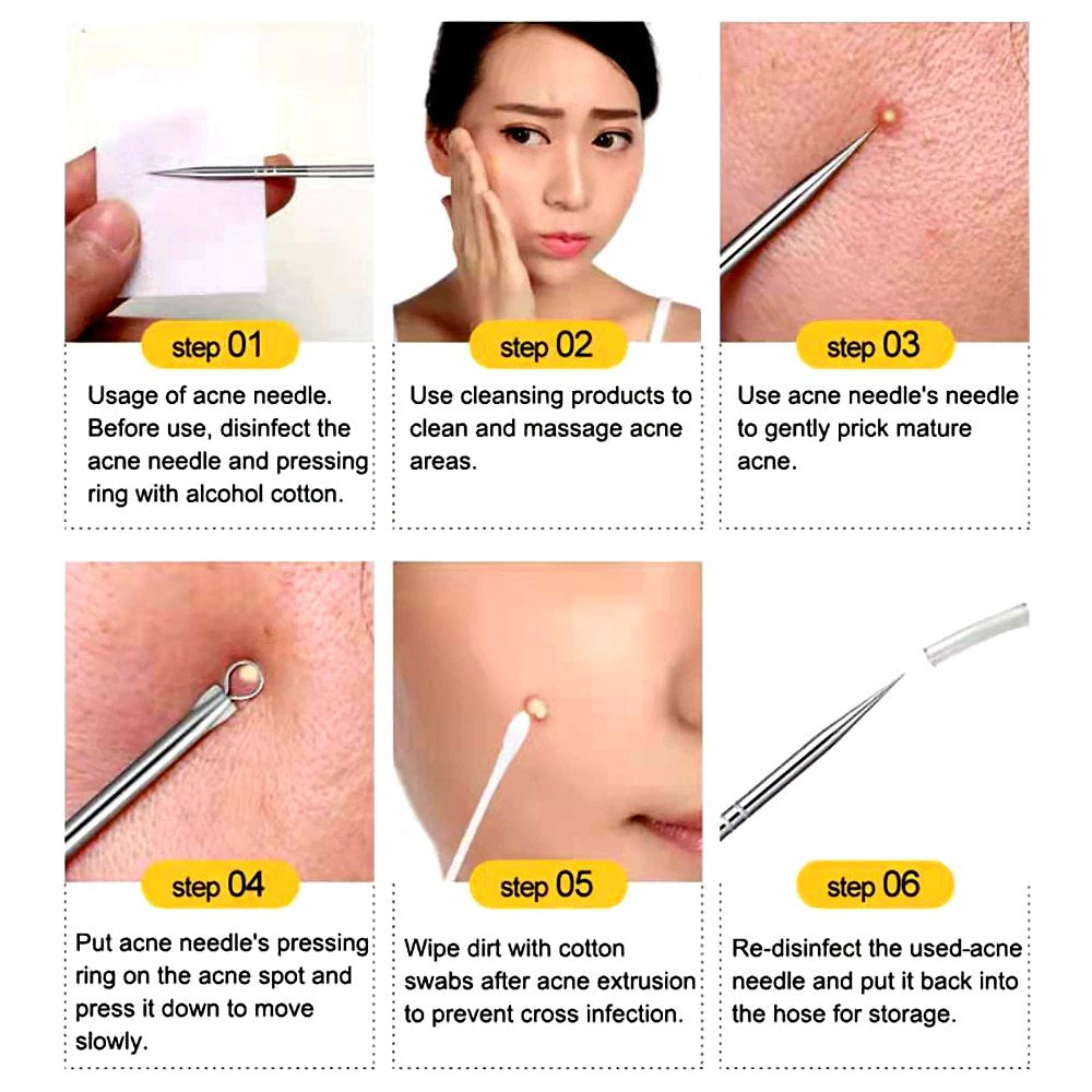 Blackhead Pimples 4pcs Stainless Steel Tools Set How To Pop Pimples Professional Kit