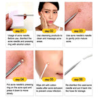 Blackhead Pimples 4pcs Stainless Steel Tools Set How To Pop Pimples Professional Kit