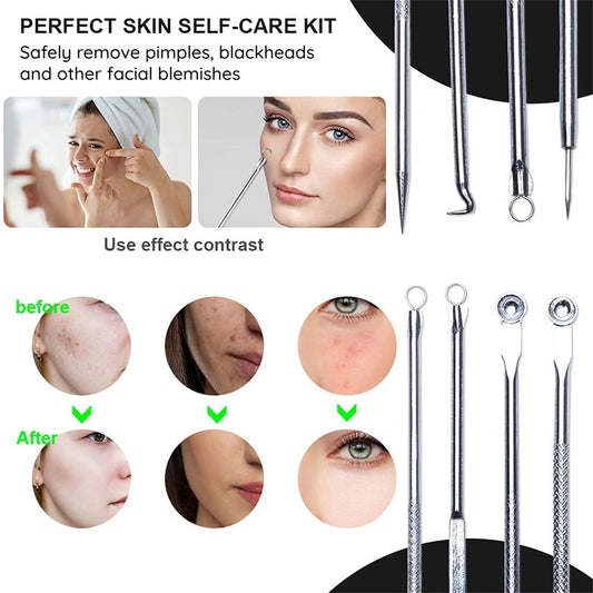 Blackhead Pimples 4pcs Stainless Steel Tools Set How To Pop Pimples Professional Kit