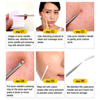 Blackhead Pimples 4pcs Stainless Steel Tools Set How To Pop Pimples Professional Kit